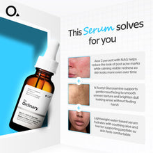 Aloe 2% + NAG 2% Solution 30 Ml