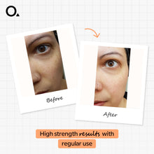 Retinol 1% in Squalane 30 Ml