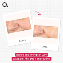 AHA 30% + BHA 2% Peeling Solution 30 Ml