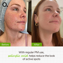 The Ordinary Salicylic Acid 2% Solution 30 ML