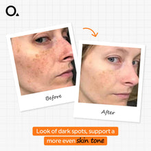 Alpha Arbutin 2% + HA 30 Ml