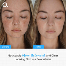 Balancing & Clarifying Serum 30 Ml