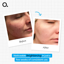 Ascorbic Acid 8% + Alpha Arbutin 2% 30 ml