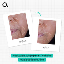 Multi-Peptide + HA Serum 30 Ml