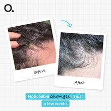 Multi-Peptide Serum for Hair Density 60 ML