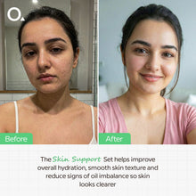 The Skin Support Set ( 30 ML two pice)